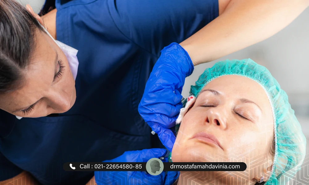 خانمی در حین لیفت نخ صورت خوابیده است. | خوابیدن بعد از لیفت با نخ