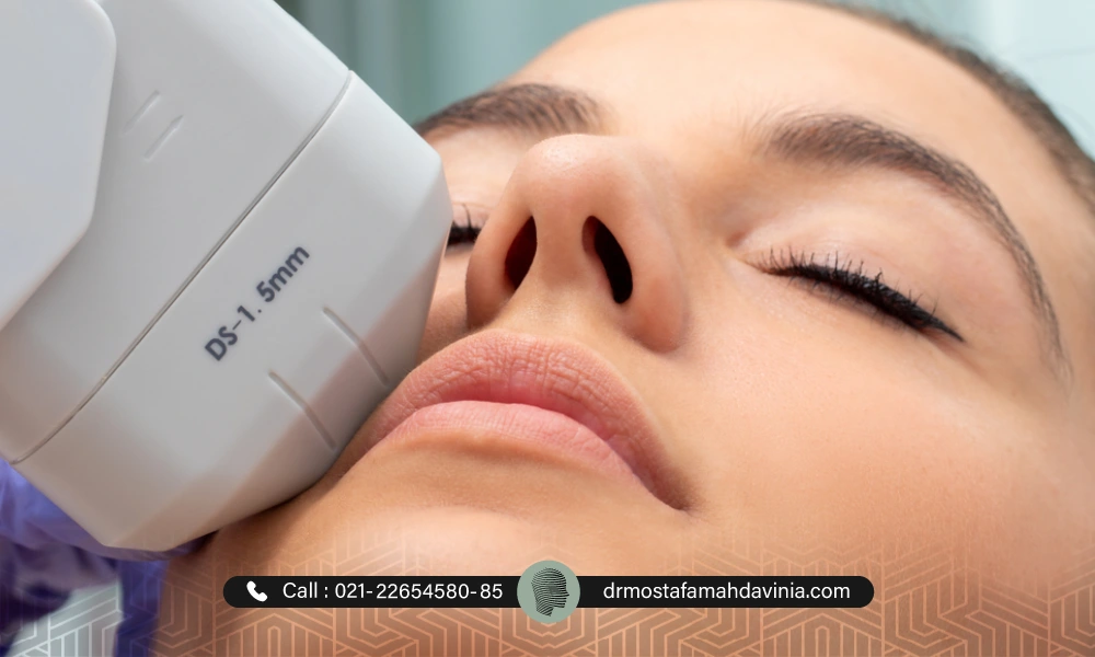 هایفوتراپی برای لاغری صورت | لاغری صورت با هایفو