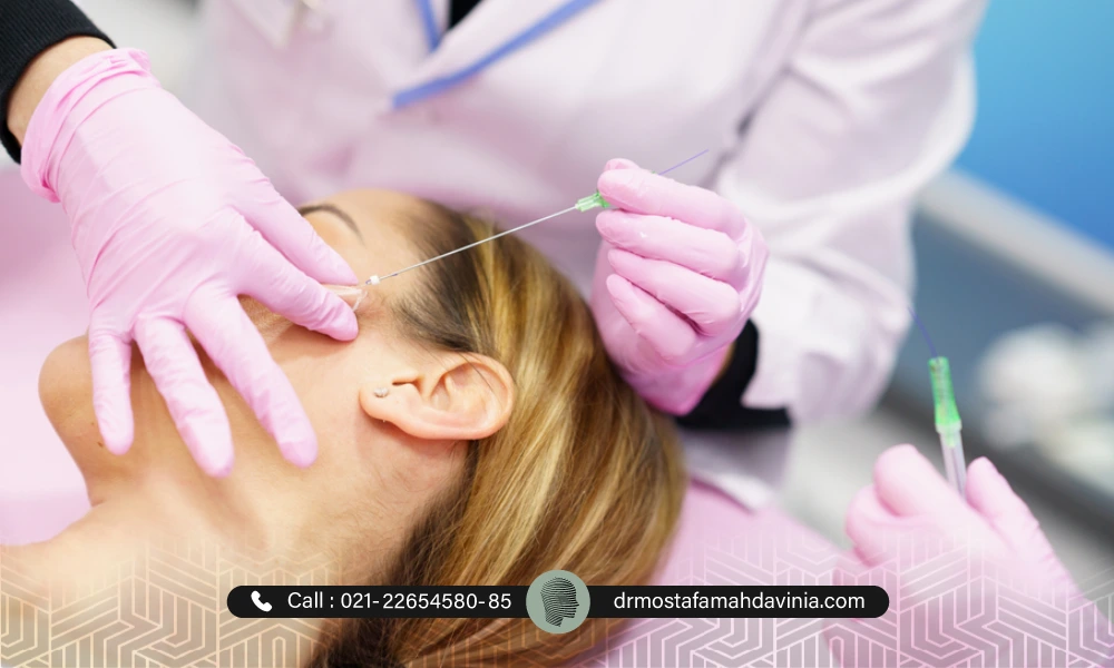 خانمی در حال انجام لیفت گونه با نخ در حالت خوابیده است | مدت زمان جذب نخ لیفت