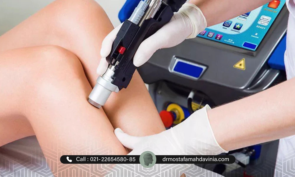 از بین بردن موهای پای خانم توسط پزشک لیزر موهای ازئد