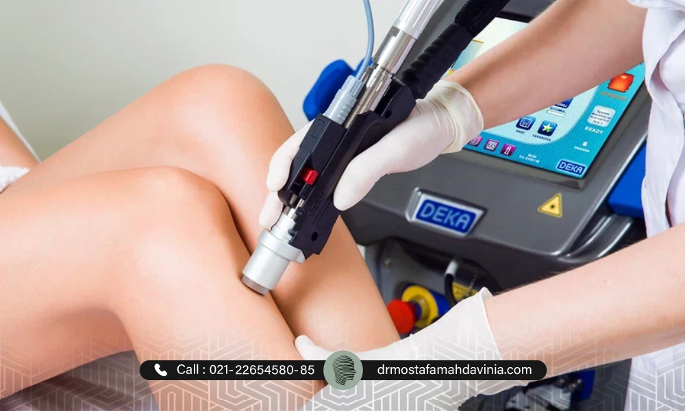 لیزر موهای زائد برای پایین زانوی متقاضی خانم | عوارض لیزر موهای زائد