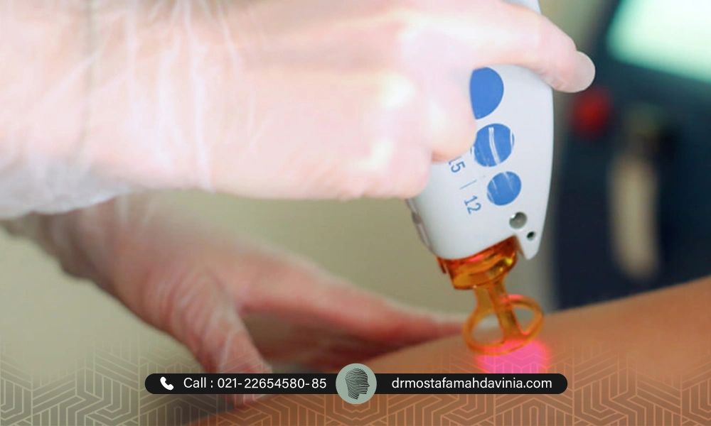 لیزر موهای زائد ران پا برای متقاضی | عوارض لیزر موهای زائد