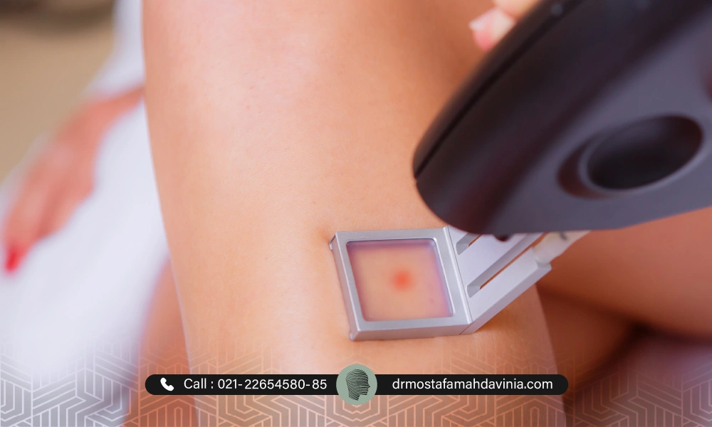 از بین بردن موهای زائد کنار ساق پا | عوارض لیزر موهای زائد