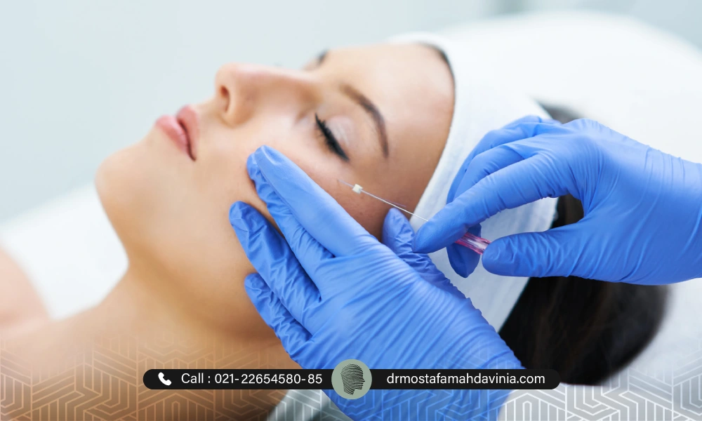 خانمی در حالت خوابیده آماده برای دریافت لیفت نخ | دوره نقاهت لیفت با نخ