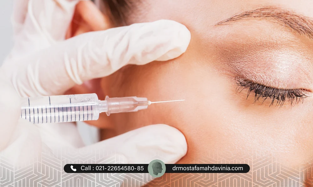 تمدید بوتاکس دور چشم