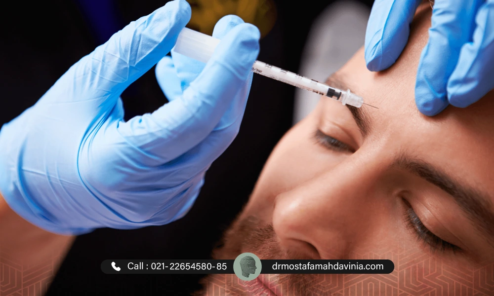 بوناکس خط اخم برای آقا | ورم بعد از تزریق ژل