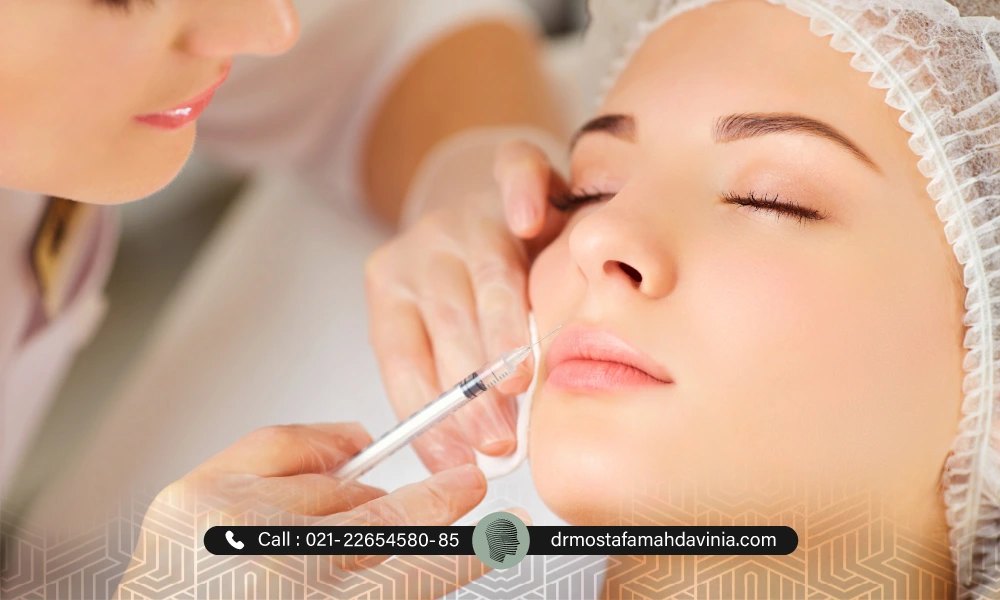 تمدید کردن بوتاکس خط خنده برای خانم متقاضی