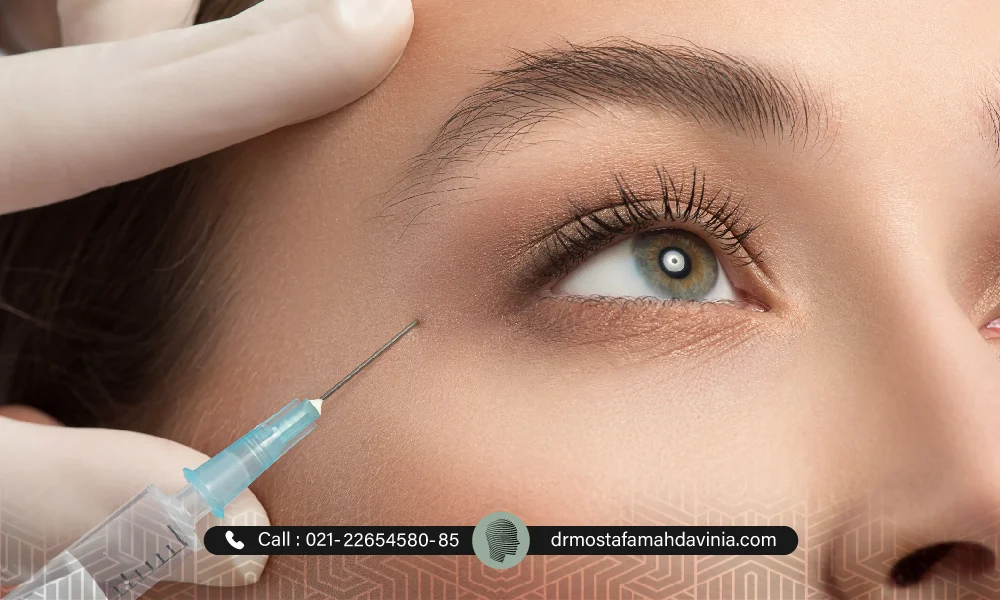 فیلر چشم برای از بین بردن چین و چروک اطراف چشم