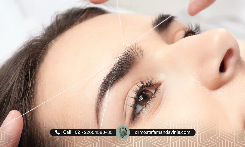 بند انداختن موهای زائد صورت | از بین بردن موهای زائد صورت