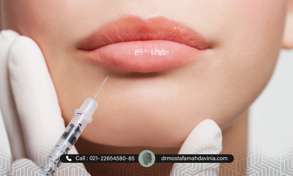 تزریق فیلر لب قبل از شیدینگ لب