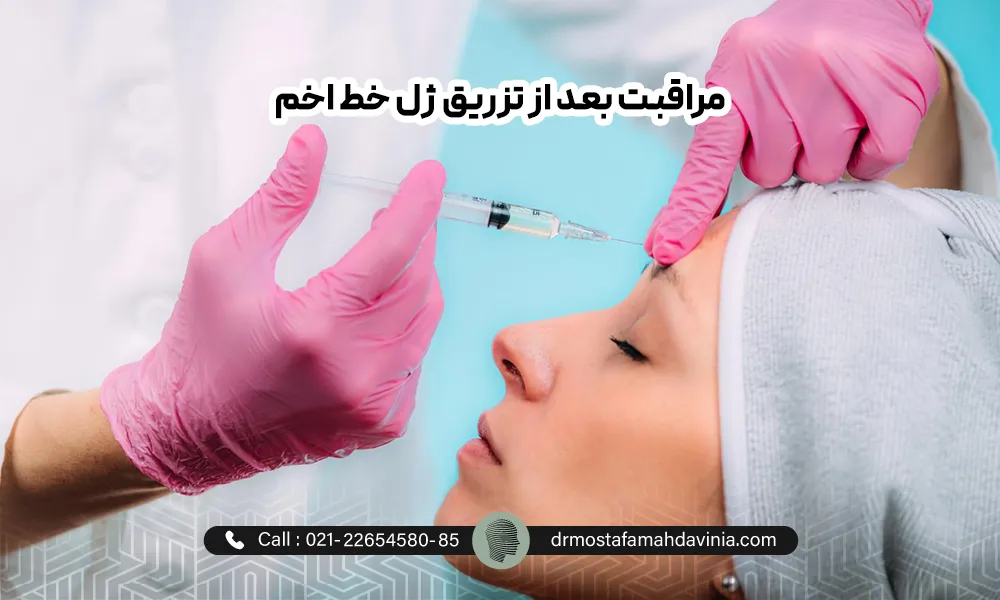 رعایت مراقبت های بعد از تزریق فیلر خط اخم