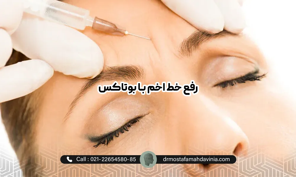 خانمی در حال درمان خط اخم عمیق با بوتاکس