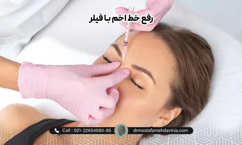 درمان خط اخم عمیق با فیلر برای یک خانم