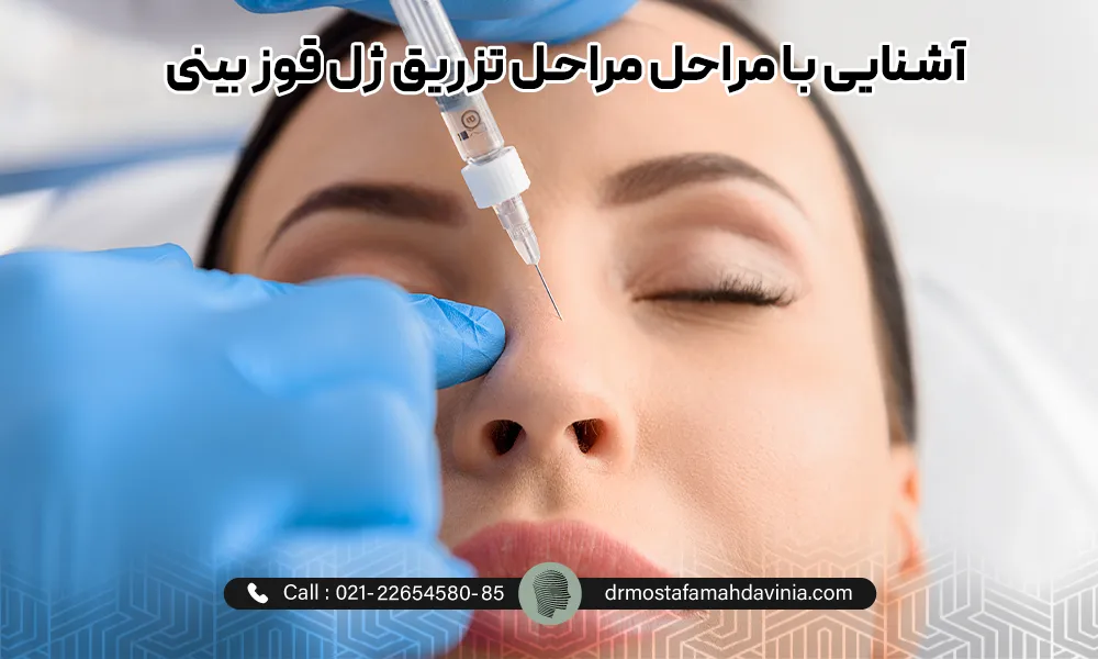 خانمی در در حال اصلاح قوز بینی با تزریق ژل که چشمان خود را بسته و پزشک در حال تزریق می باشد.