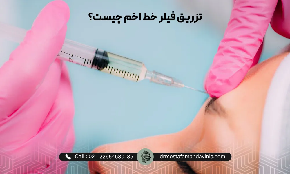 پزشک با دستکش های صورتی در حال تزریق فیلر خط اخم برای یک خانم