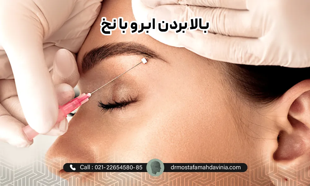 لیفت نخ برای بالا بردن ابرو