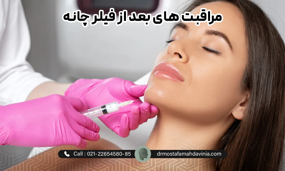 تزریق فیلر به چانه یک خانم | مراقبت بعد از فیلر چانه​