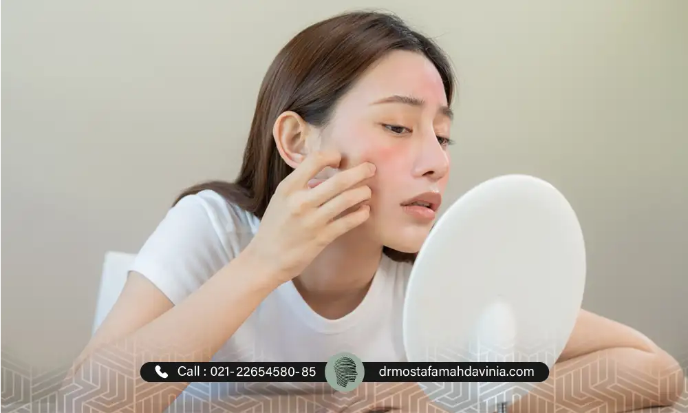 خارش بعد از تزریق ژل صورت