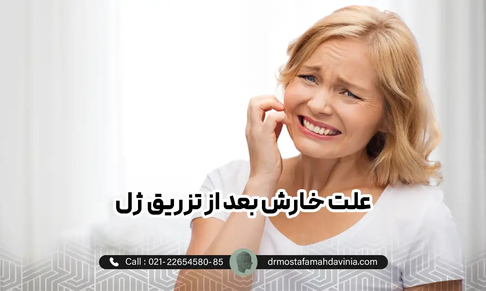 خانمی در خاراندن صورت خود در اثر خارش بعد از تزریق ژل