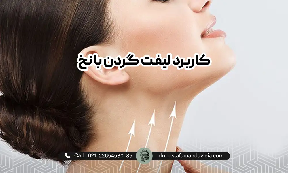 عکس خانمی که به لیفت گردن با نخ خود اشاره می کند.