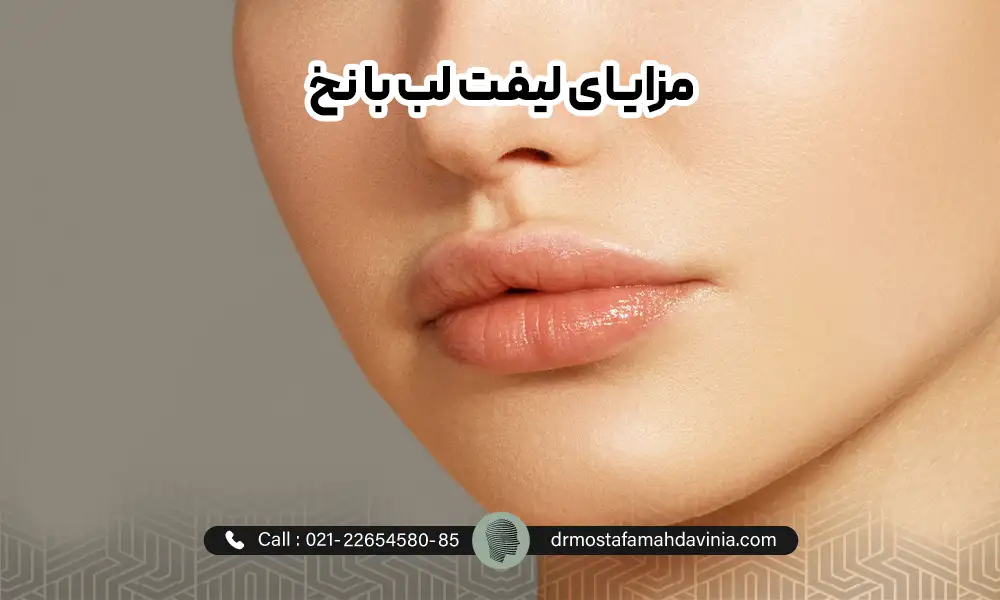 خانمی که روی لب های خود لیفت لب با نخ انجام داده است.