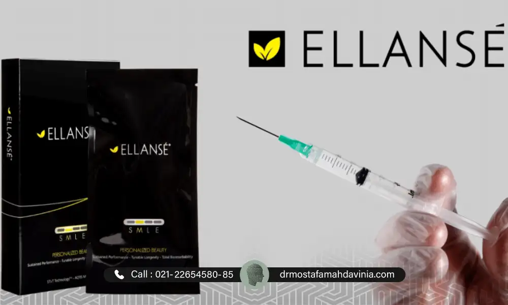 عکس فیلر الانسه