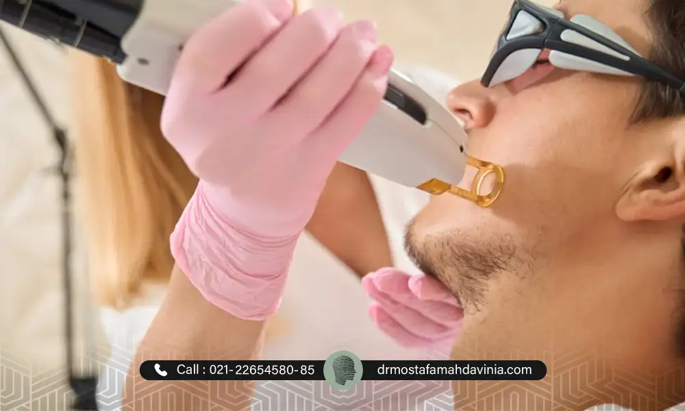 تعداد جلسات لیزر موهای