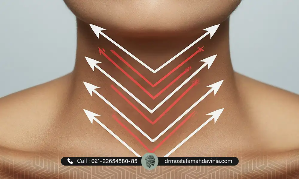 عکس لیفت گردن با نخ