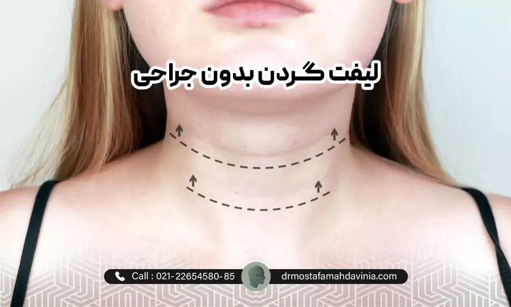 خانمی که سر خود را بالا گرفته برای نمایش نیاز به لیفت گردن با نخ.