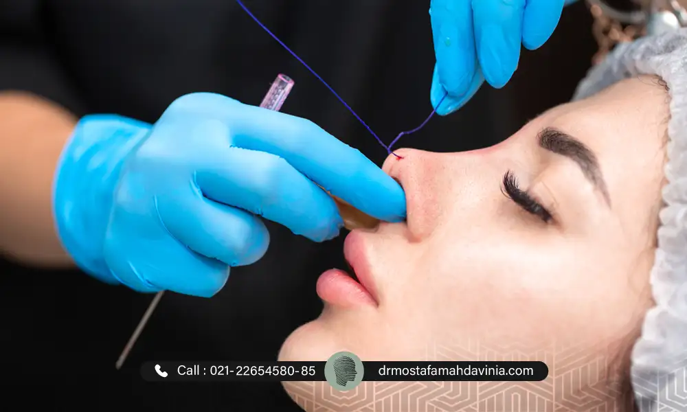 پزشک زیبایی در حال انجام لیفت بینی با نخ