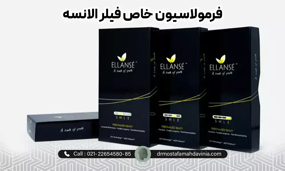 جعبه های فیلر الانسه