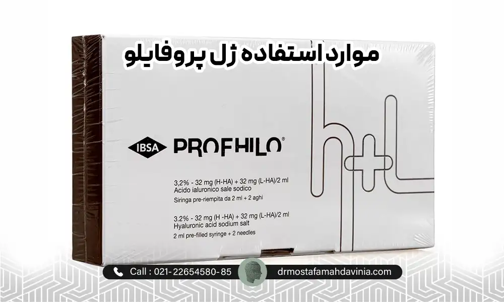 فیلر پروفایلو 