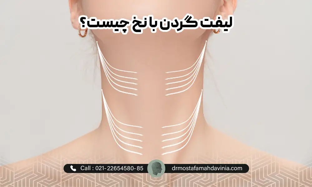 فلشی که به لیفت گردن با نخ اشاره دارد.