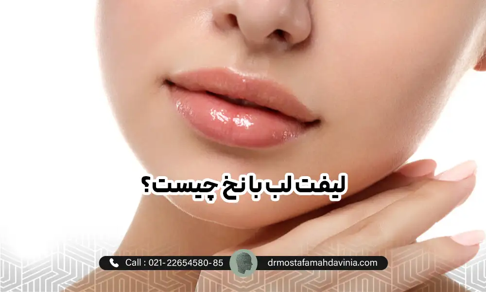 لب های جذاب خانمی بعد از لیفت لب با نخ