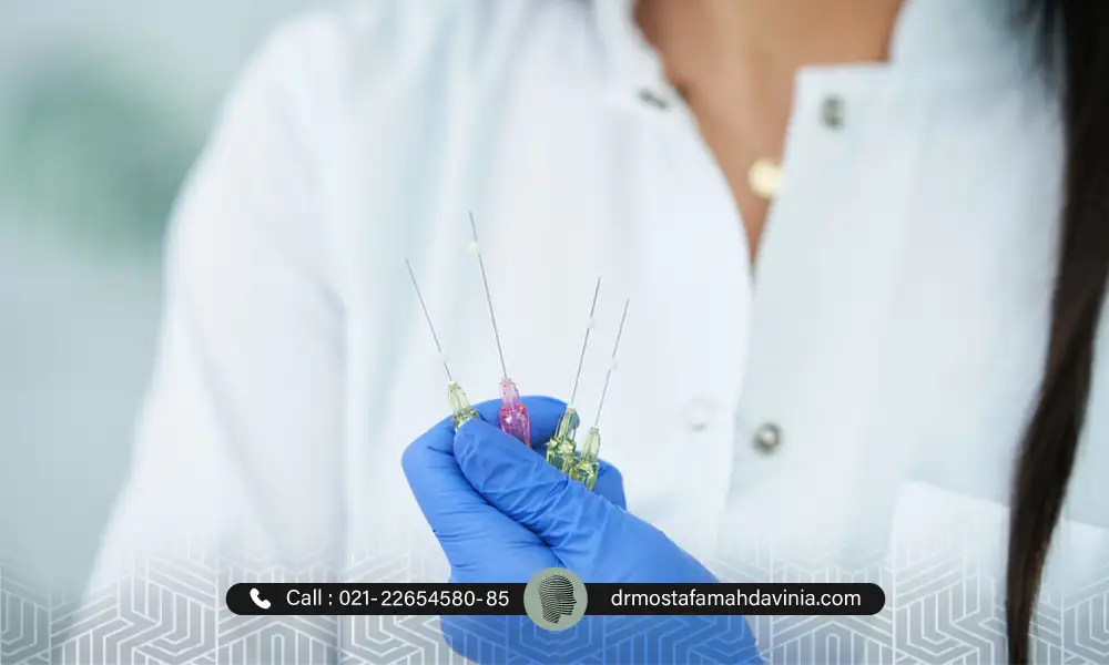 نخ های لیفت نخ در دستان پزشک زیبایی | مراقبت های بعد از لیفت نخ