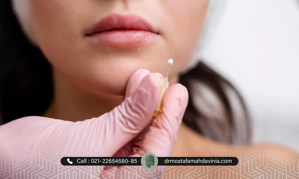 خانمی در انتظار لیفت نخ تهران