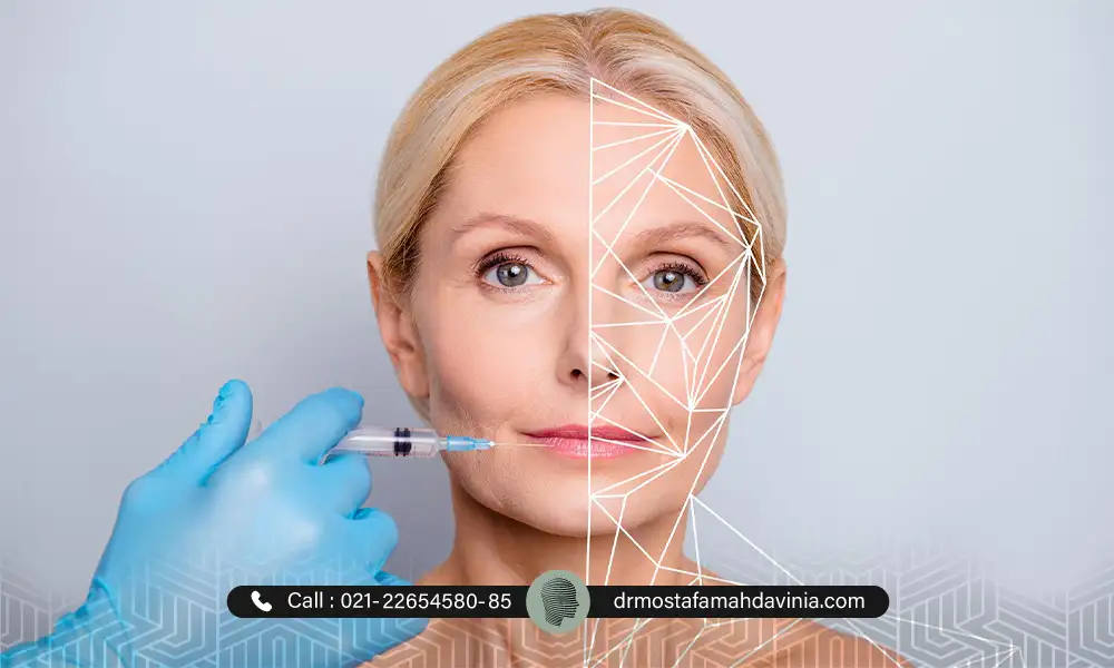 مشخص شدن نقاط تزریق فیلر فول فیس بر روی صورت یک خانم