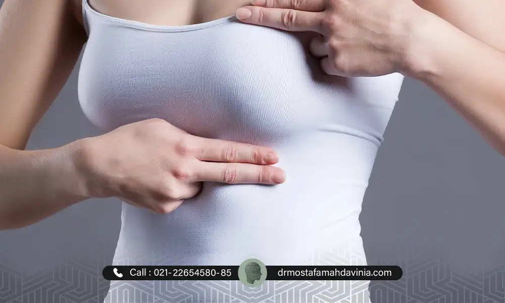 خانمی در حال نشان دادن سینه های خود بعد لیفت سینه با نخ