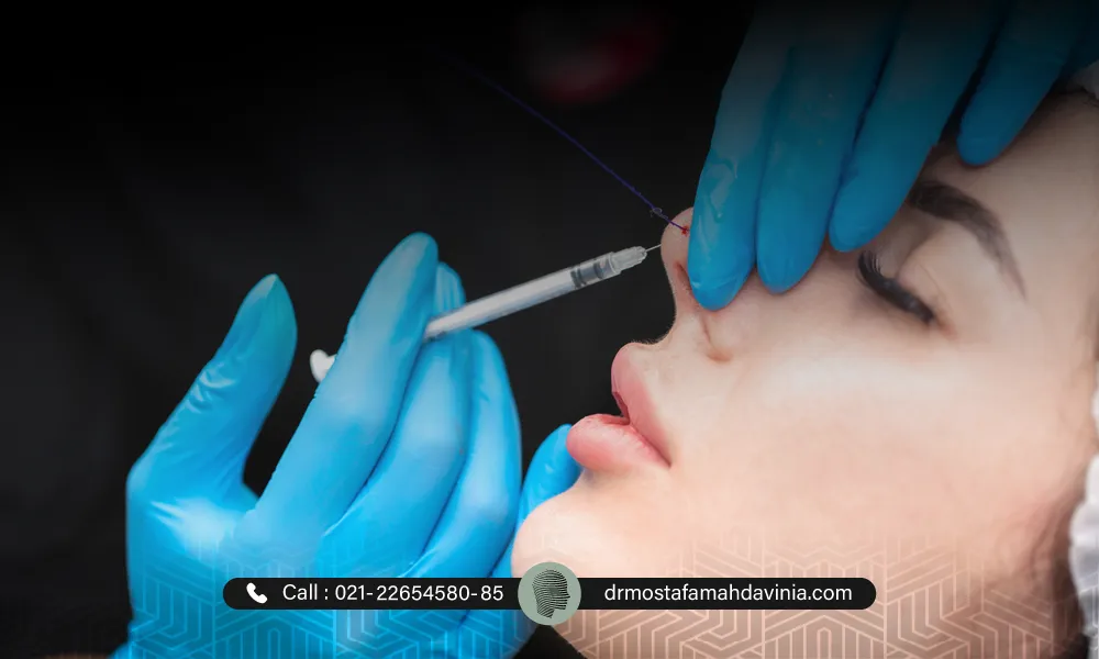 انواع نخ ها برای لیفت بینی گوشتی