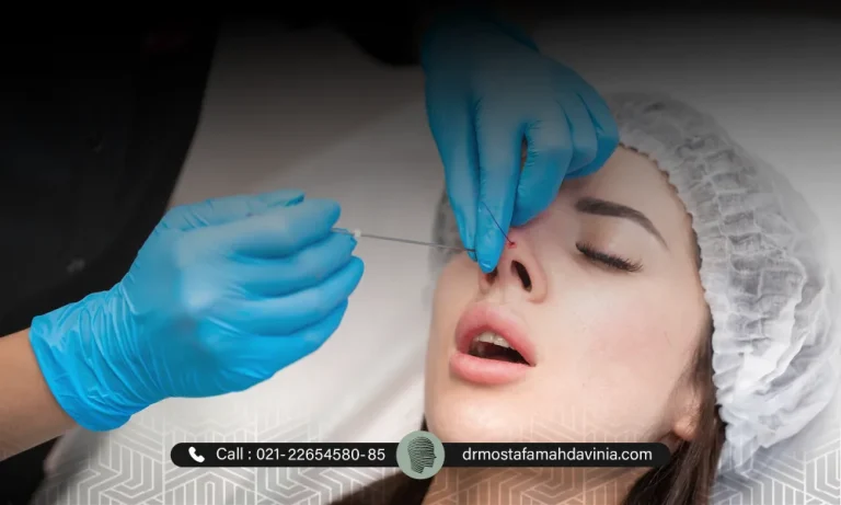 لیفت نخ بینی گوشتی