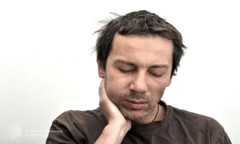 ورم بعد از بوتاکس