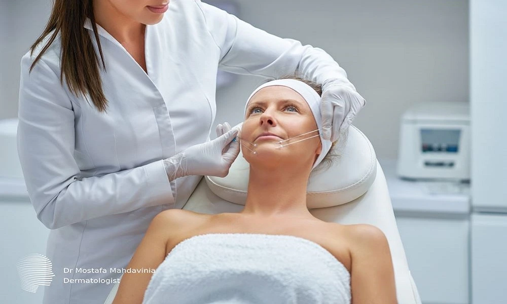 کاربردهای نخ آپتوس