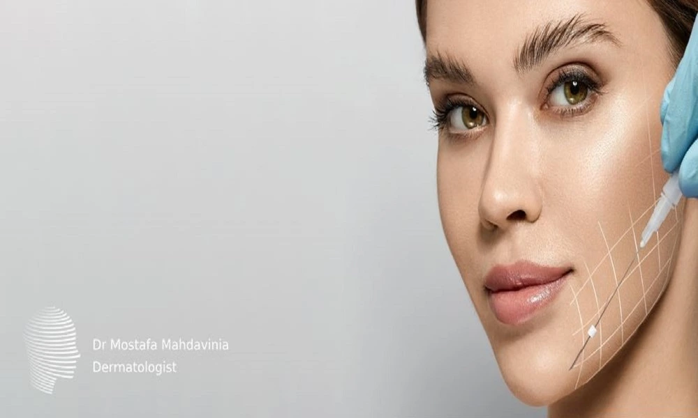 لیفت با نخ آپتوس