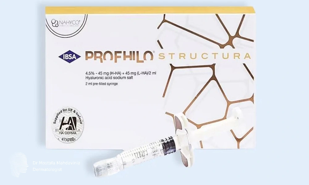 پروفایلو استراکچرا